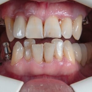 a person's mouth with teeth and tongue